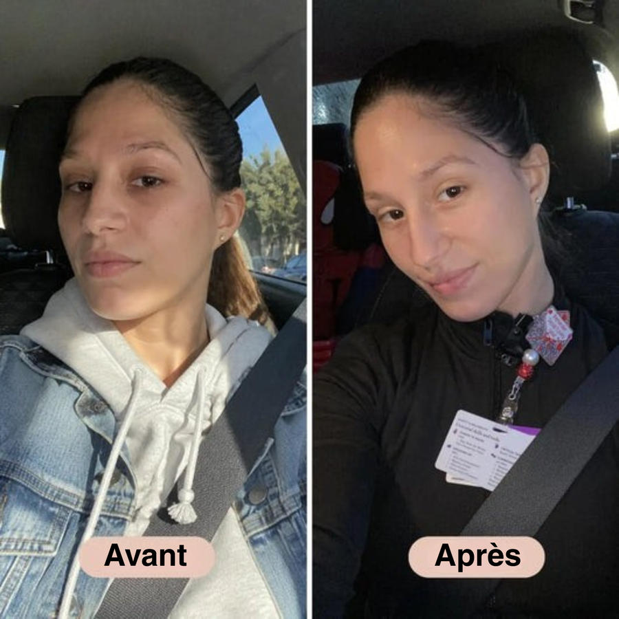 Ilyana | Baume Coréen Contour des Yeux